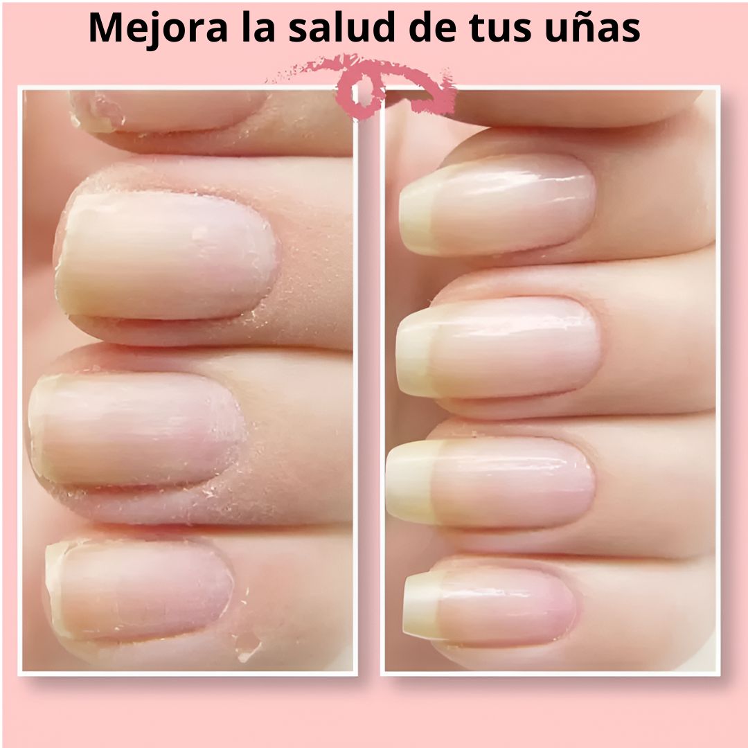 Nail Gel© - Gel reparador de uñas quebradas