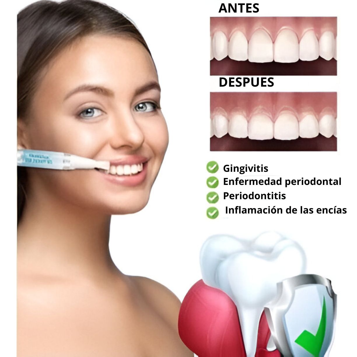 Gum Gel© - Corrector de encías para dientes