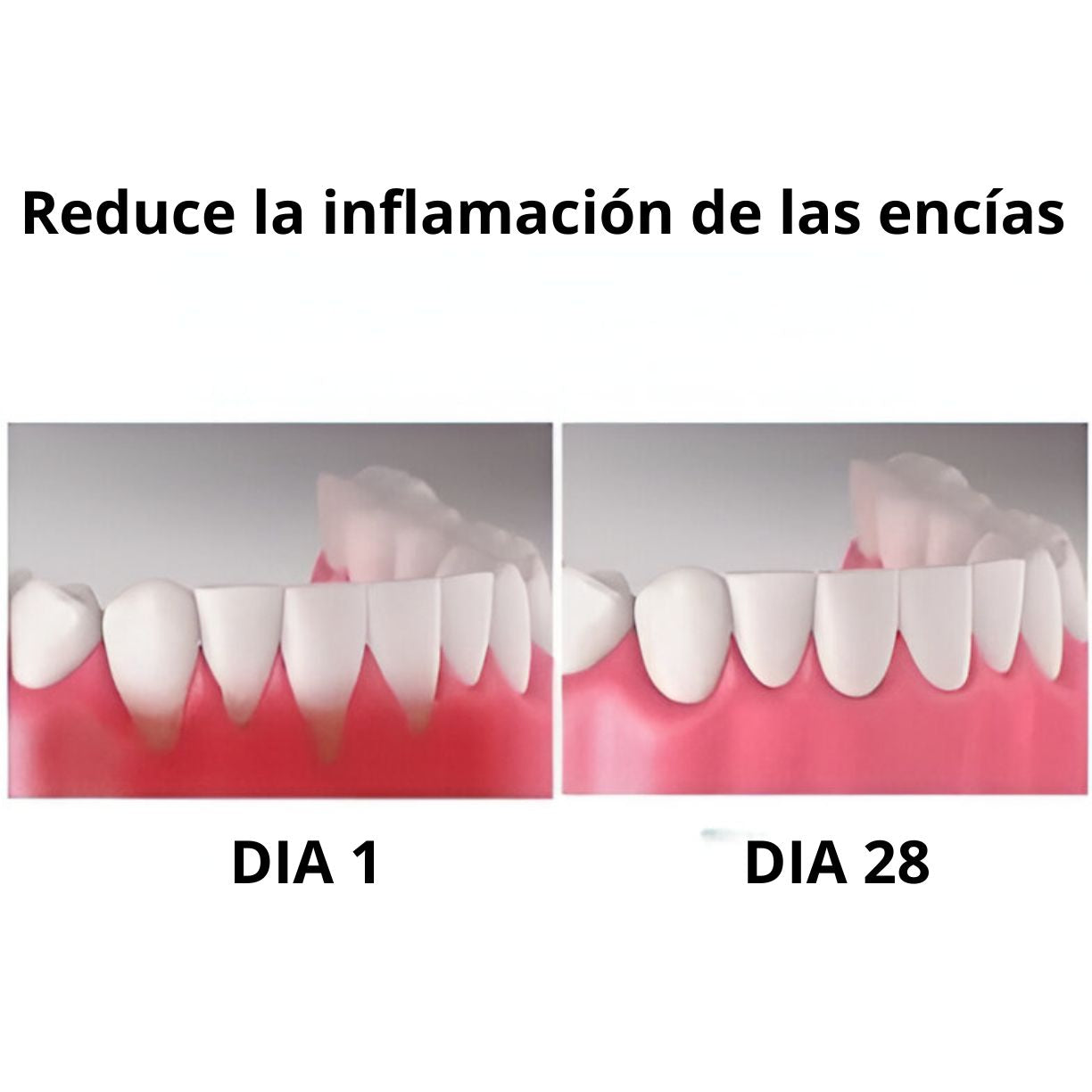 Gum Gel© - Corrector de encías para dientes